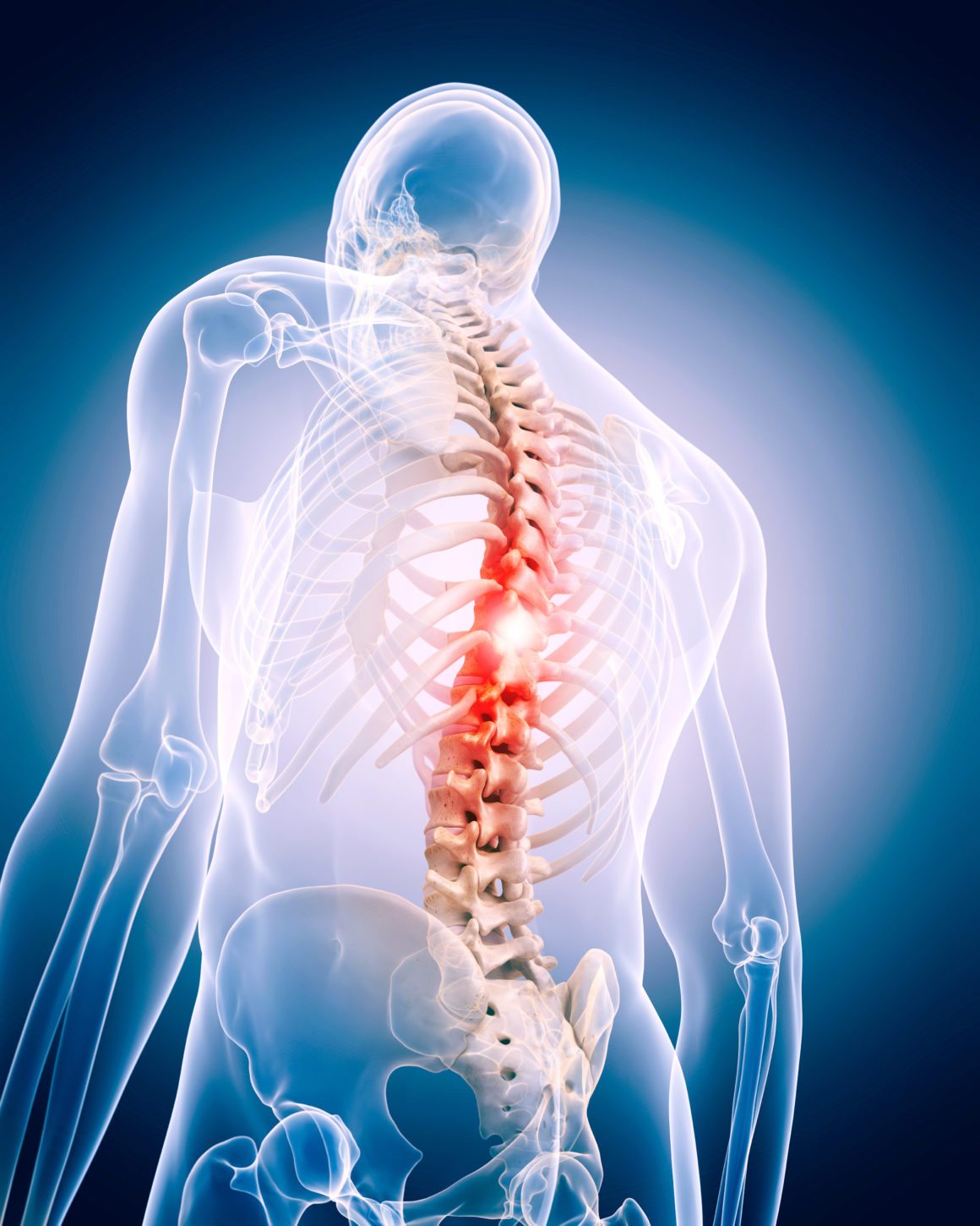 Best Spine Surgery Hospital in India