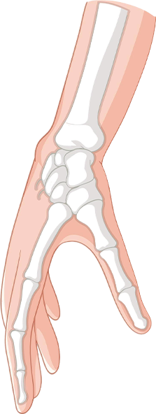 No 1 Spastic Surgery Hospital in India