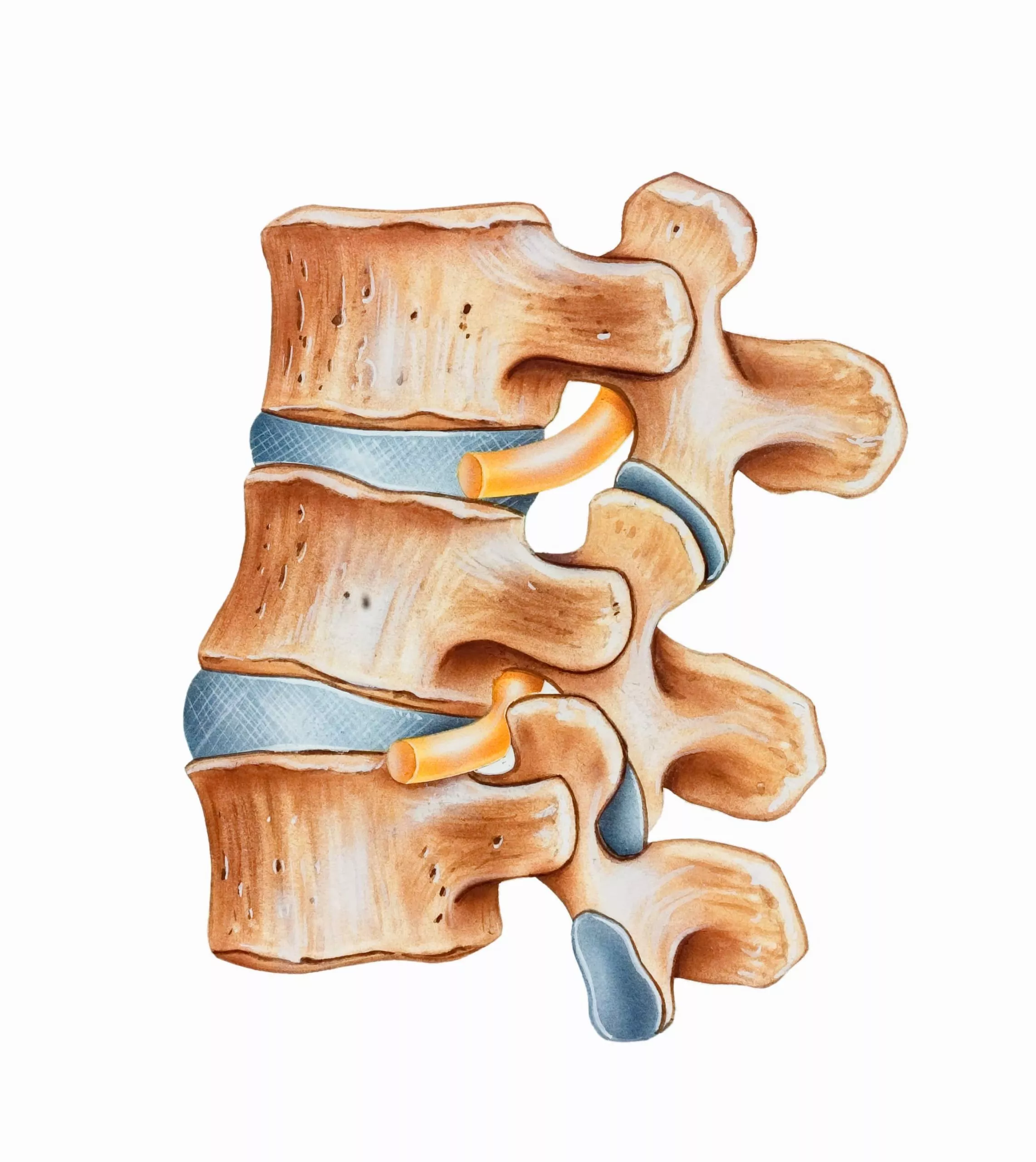 Disc Replacement/Fusion